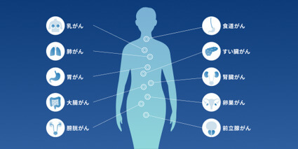 どんな臓器のがんの可能性がわかる？